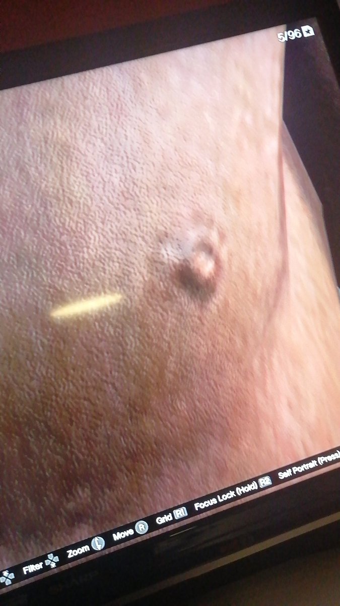 The_Bus78's tweet photo. @DierikTheBusDad sexy nipple #fuckyoubecky https://t.co/LzWpTbmkgR