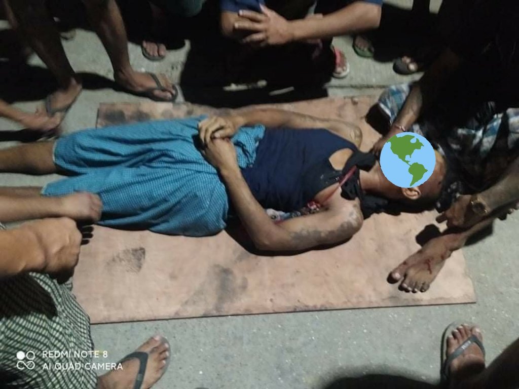 YanonePhue's tweet photo. tw // blood // wound
2 civilians were shot in Thaketa last night
- one in the neck and one in the waist. (in serious condition )
Terrorists were shooting before internet cut off and conditions are severe as the night continued.
JUNTA MASSACRE 
#WhatsHappeningInMyanmar 
#Mar28Coup https://t.co/mxubnGHXiJ