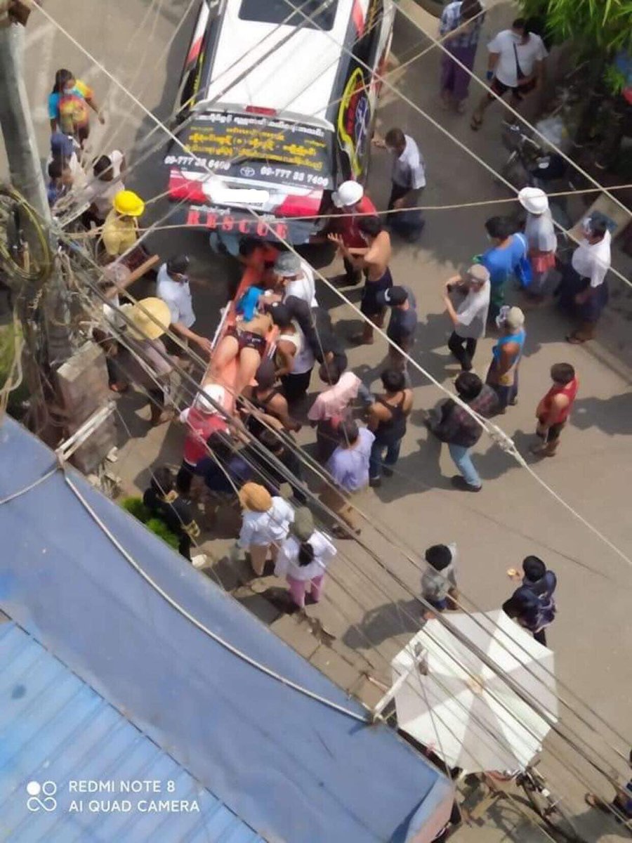 tw // blood

2 people got injured cus of throwing bombs by Min Aung Hlaing's terrorist group. 1 loat his hand and 1 got injured his thigh. 

<a href="/UN/">United Nations</a> <a href="/freya_cole/">Freya Cole</a> 

#Mar28Coup #WhatsHappeningInMyanmar