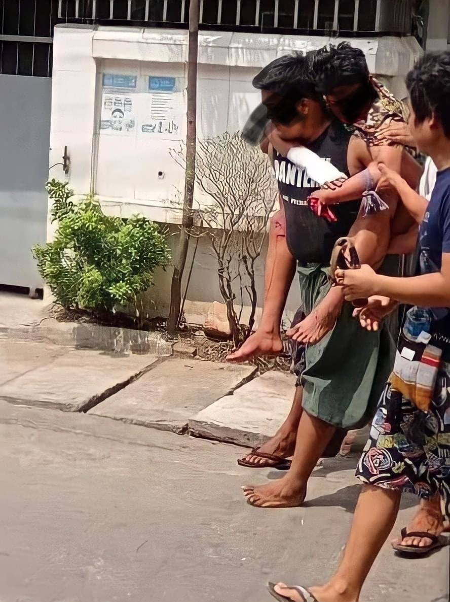 tw // blood
Locals heard a very loud explosion and gunshots at 10 am in Thiri Myaing, Hlaing Township. A man lost his hand due to that explosion. It is not known whether it’s just a sound bomb or not.

JUNTA MASSACRE 
#WhatsHappeningInMyanmar 
#Mar28Coup