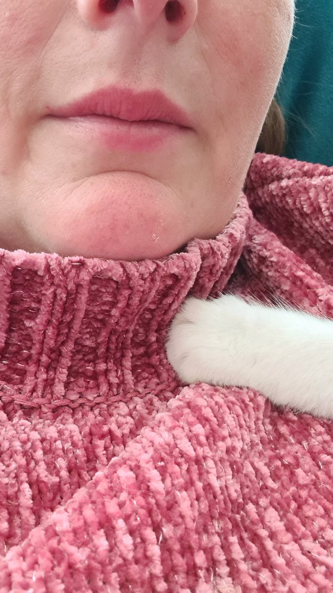 Carefully placed paw and a purr in the ear. Cat speak for i love u my hooman ♥