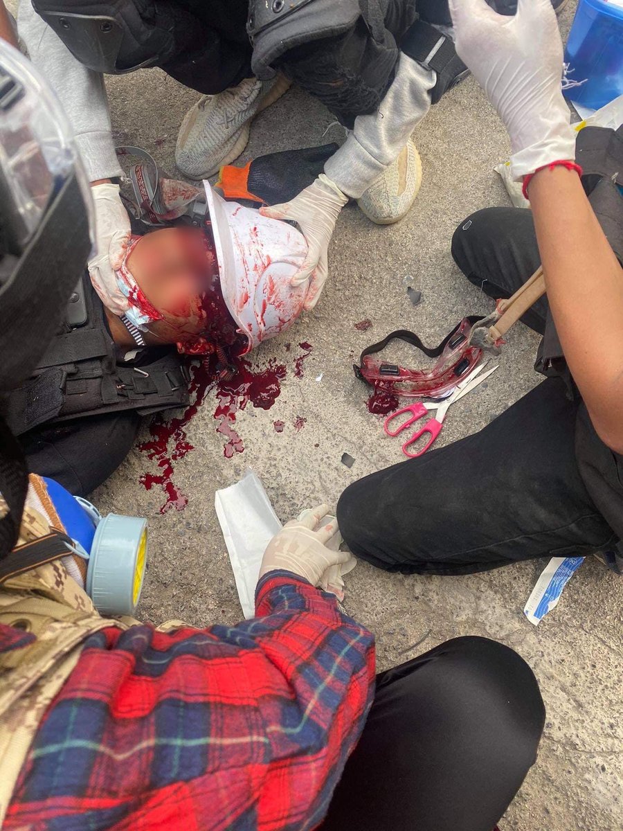 hannayuri_twt's tweet photo. Tw // Gunshot // Blood 

Happening Now 
Military Terrorists violently cracked down in Taunggyi,Shan State. One was hit in the head and he was send to nearby hospital.Another one got hit in the thigh,other injuries and abductions on people https://t.co/KrTwxYIzgp