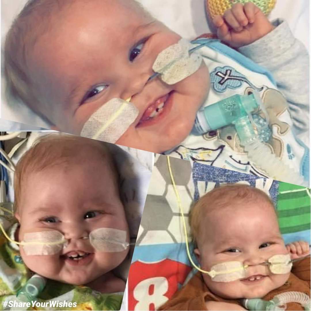 share_wishes's tweet photo. A year ago today gorgeous Cole passed away at 8 months old just weeks after receiving a #HeartTransplant. Cole’s mammy &amp; daddy, Lauren and Rich found out at their 20 week scan that Cole had a serious &amp; rare heart defect - hypoplastic left heart syndrome❤

https://t.co/4yPb6YBo6K https://t.co/mh2C2G01sh