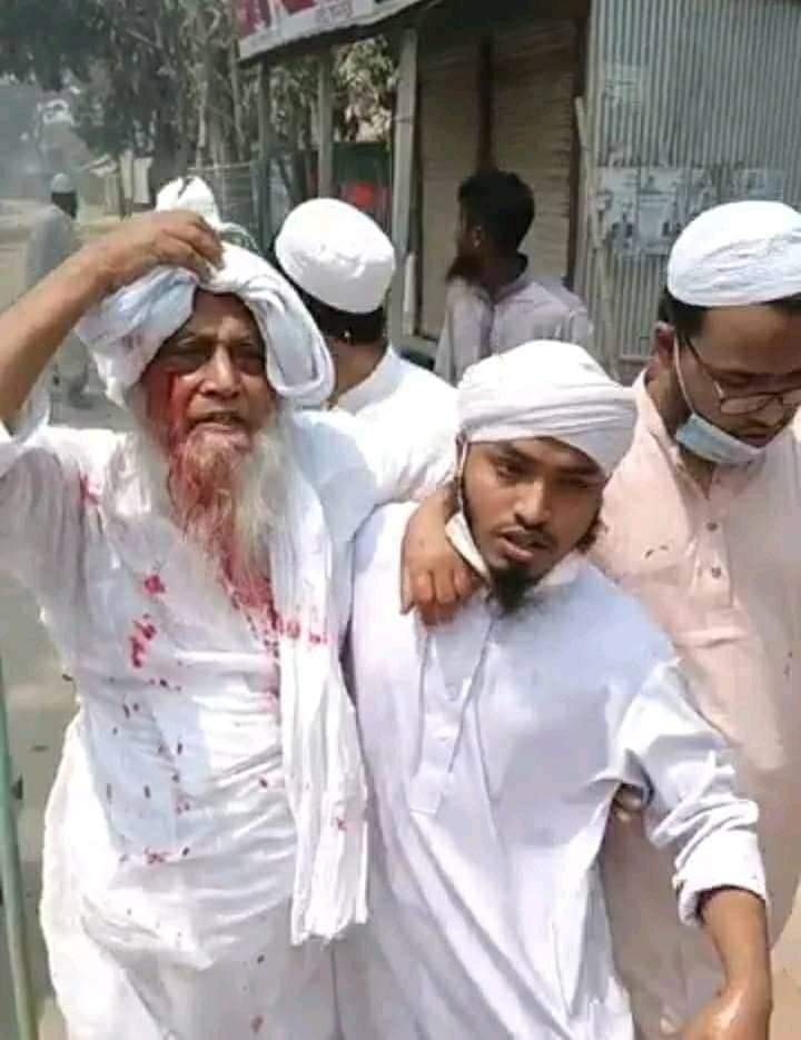 HJakwan's tweet photo. ইন্না-লিল্লাহ! 

মদুপুরের পীর সাহেব শীবসেনার জারজ সন্তানদের দ্বারা গুলিবিদ্ধ,  ইয়া অাল্লাহ। https://t.co/rSjzaAovXj