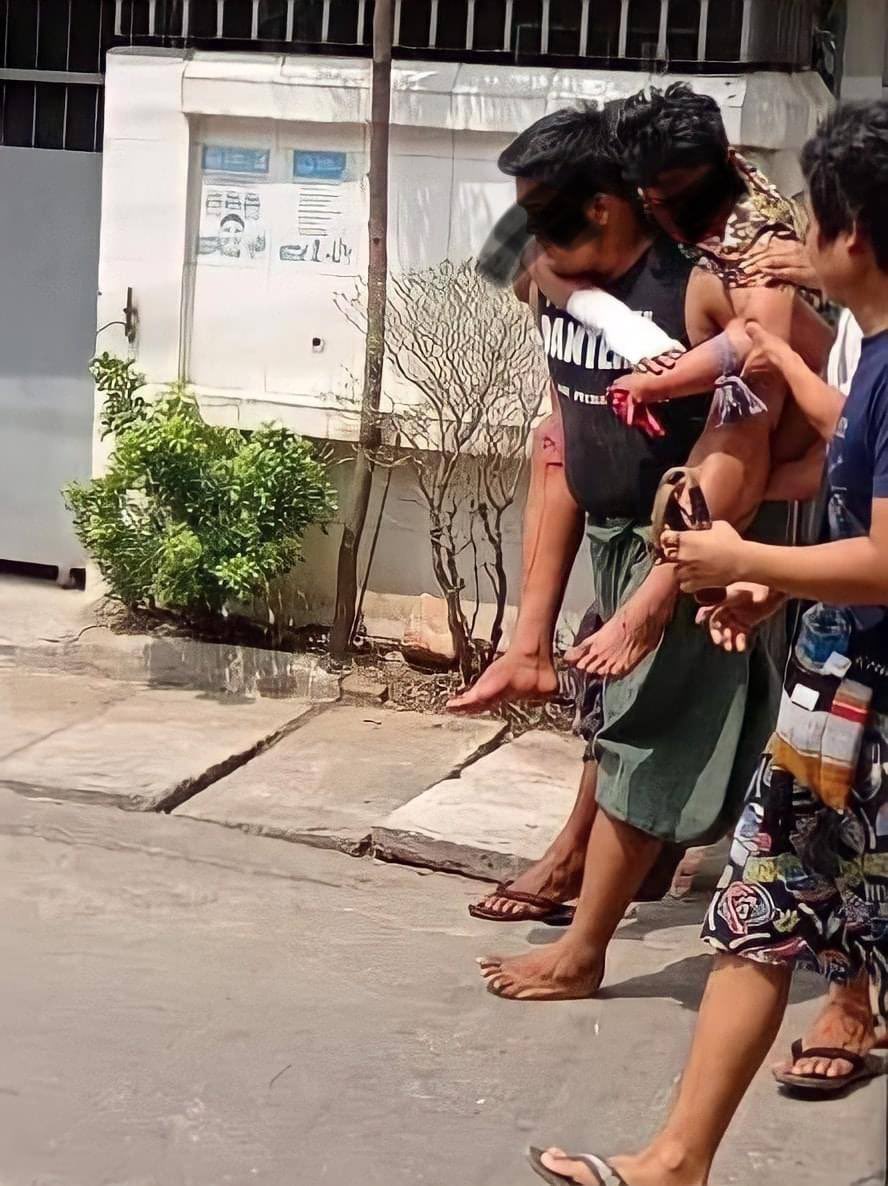 tw // blood
Locals heard a very loud explosion and gunshots at 10 am in Thiri Myaing, Hlaing Township. A man lost his hand due to that explosion. It is not known whether it’s just a sound bomb or not.

JUNTA MASSACRE 
#WhatsHappeningInMyanmar 
#Mar28Coup