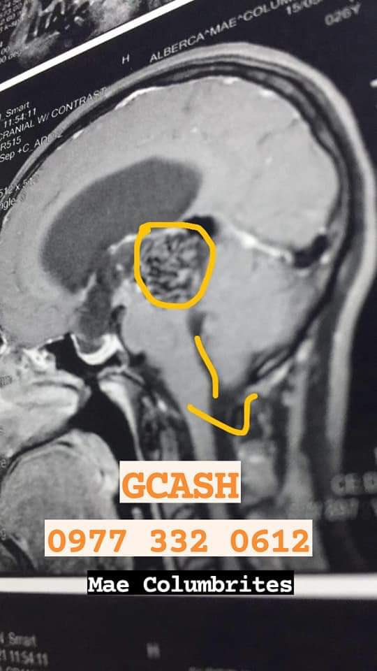 _gymmontoya's tweet photo. hi, my cousin is in much need of monetary assistance. she is currently suffering from stroke mimicker and needs to be operated ASAP. we’re asking for a little help bc our family needs almost a million for her to go through her medical procedure. any amount is much appreciated 🤍 https://t.co/Khphw8A0qJ