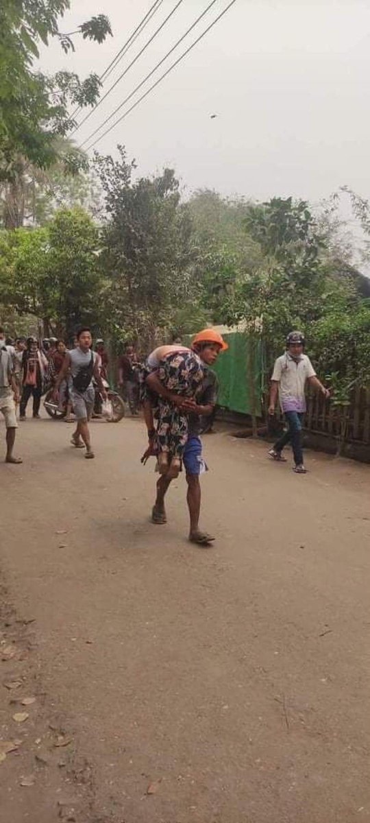 Maria89599527's tweet photo. Tw//blood
2 girls from medic team have been shot in #MoneYwar,YadanarPone Ward today. One has been shot in legs and one in head.
JUNTA MASSACRE 
#Mar28Coup
#WhatsHappeningInMyanmar https://t.co/jtjD87XfOm