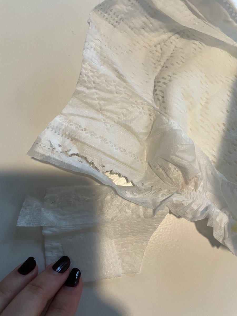 ChelseyPG's tweet photo. @Pampers all my diapers keep ripping in the same place. This week alone we’ve thrown out 6 diapers $$$$ What’s the deal? https://t.co/lbqg85kS7y