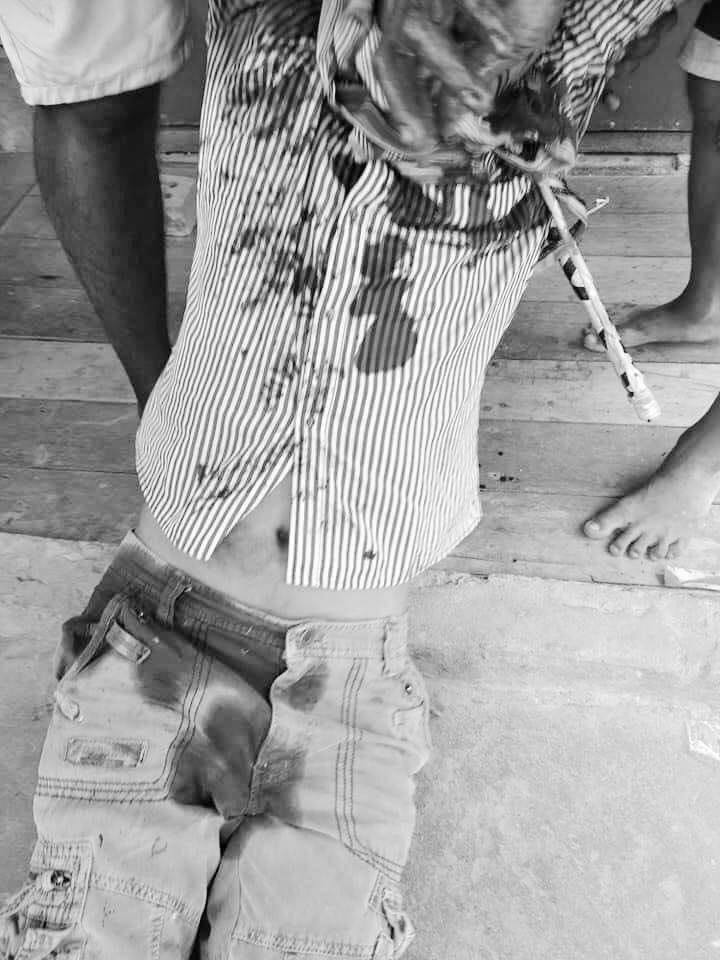 Emilyemyemy19's tweet photo. Tw // blood , death 
In South Dagon township , #Yangon , a man was shot to death at his neck by military terrorists on March 28 afternoon.

JUNTA MASSACRE 
#WhatsHappeninglnMyanmar #Mar28Coup https://t.co/JsVRkcPUDg