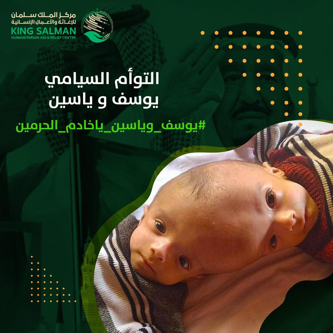 SeiyunCity's tweet photo. 🔴فضلا لا أمرا .. انسخ التغريدة وغرد بها👇🔴

أنا يوسف والملتصق بي أخي ياسين
لم استطيع رؤية ياسين وهو كذلك لأننا خلقنا متلاصقين .. 
عمرنا ٦ أشهر ..
نعيش بمحافظة #حضرموت
مدينة #سيئون ..

أنقذونا

#يوسف_وياسين_ياخادم_الحرمين

@KingSalman
@KSRelief 
@mohdsalj
@Dr_abdlahrbiah https://t.co/cqHobg1J9s