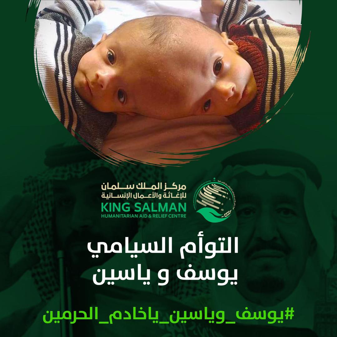 SeiyunCity's tweet photo. 🔴فضلا لا أمرا .. انسخ التغريدة وغرد بها👇🔴

أنا يوسف والملتصق بي أخي ياسين
لم استطيع رؤية ياسين وهو كذلك لأننا خلقنا متلاصقين .. 
عمرنا ٦ أشهر ..
نعيش بمحافظة #حضرموت
مدينة #سيئون ..

أنقذونا

#يوسف_وياسين_ياخادم_الحرمين

@KingSalman
@KSRelief 
@mohdsalj
@Dr_abdlahrbiah https://t.co/cqHobg1J9s