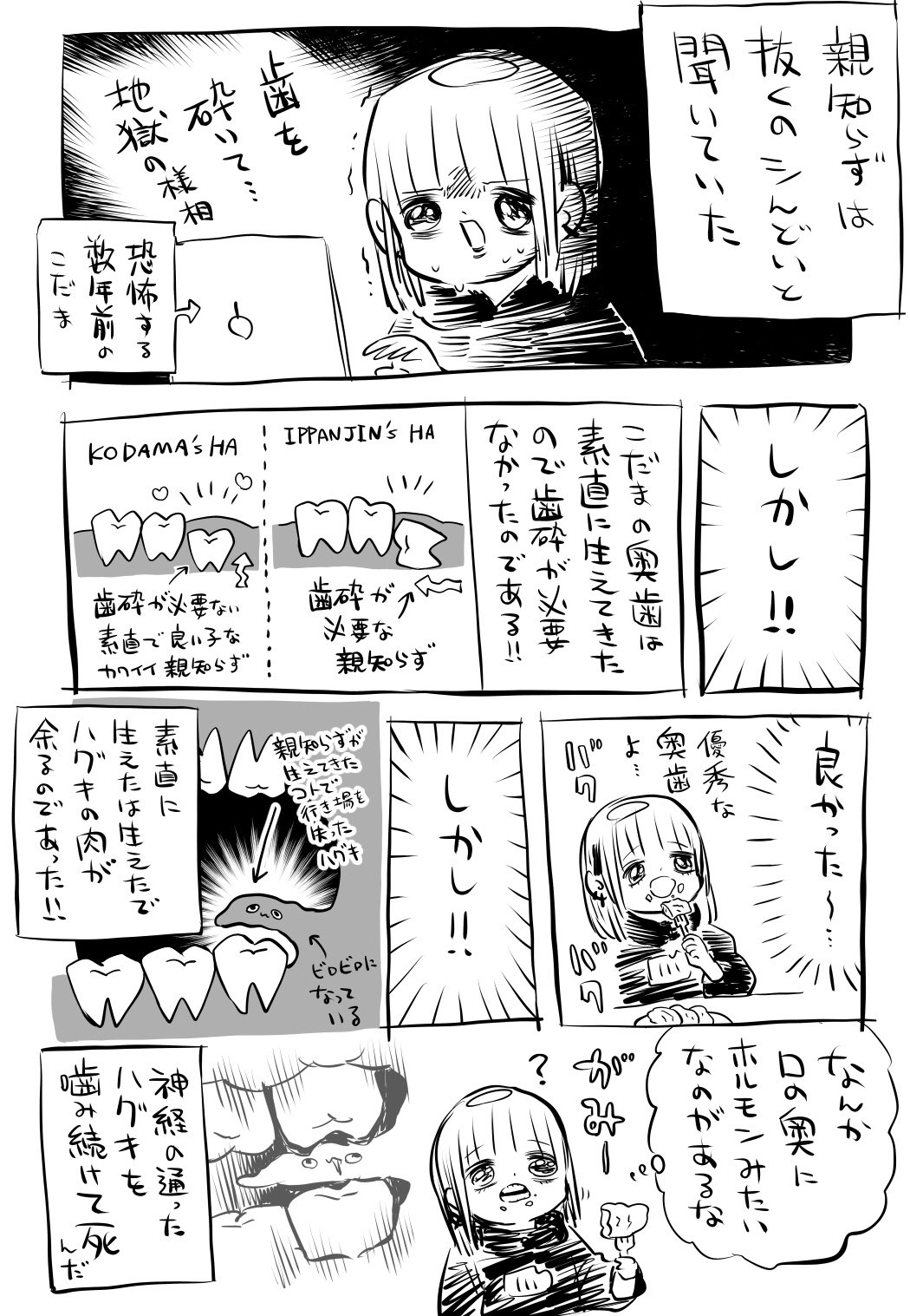 親知らずを放置した結果 神経の通った歯茎を噛み続けてしまう 話題の画像プラス 親知らずを放置した結果 神経の通った歯茎を噛み続けてしまう 話題の画像プラス