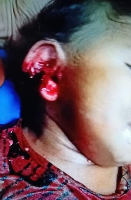 A one and half year old baby girl was shot by security forces at her home in South Dagon, Yangon on Sunday night #WhatHappeningInMyanmar