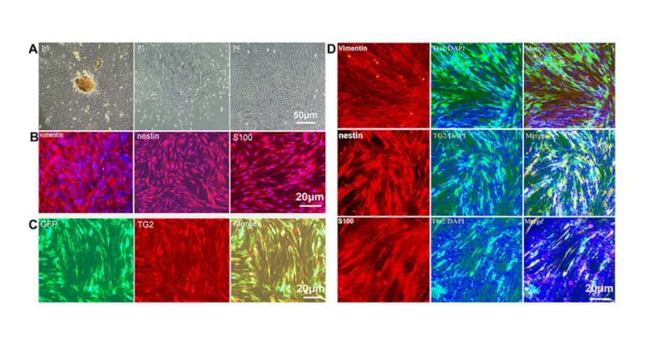 ExtracellMatrix's tweet photo. New research: Scientists indicate that a #TissueEngineered bone-like graft could improve the process of bone defect repair. 🦴
https://t.co/EcEzrhB8UJ https://t.co/4CQL4F8hSY