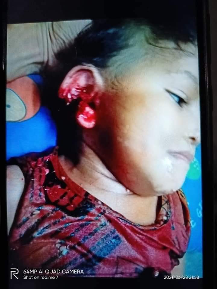 At South Dagon Iin Yangon, Myamar, the child gets the shoot from Military tonight. According to the news, the Military cut off the wifi cable at this area and they even use machine guns to shoot the people. 
#WhatIsHappeningInMyanmar 
#InternetShutdown 
#SAVETHECHILDERNMyanmar