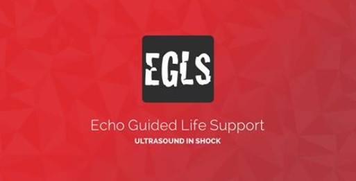 POCUSClub's tweet photo. #EGLSGalway2021 is happening on June 26th Sat / 27th 2021 Sun. Learn how to use ultrasound to guide your management of patients with #shock. 9 CPD for the day by @COAIrl. ping @RCSI_Irl @RCPI_Trainees @RCPI_news #echofirst #fusics https://t.co/EaMfYYCKxF to book. https://t.co/hDyqAyWkgb