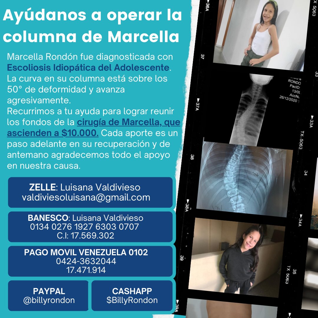luisywood's tweet photo. Mi hija necesita ser operada para evitar que se siga deformando su columna 
¡Hoy pido de tu ayuda y solidaridad!
https://t.co/gQCKXJ1RPe https://t.co/z5l4H45bN3