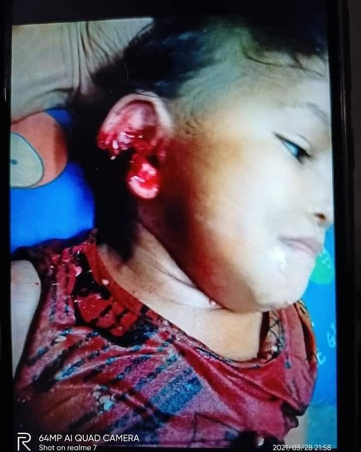 haymarn_tun's tweet photo. Our children are not safe anymore. 
According to this: how can we survive under military coup? Where's our future?
Where's our hope?

#whatshappeninginmyanmar 
#hearthevoiceofmyanmar 
#crimesagainsthumanity 
#rejectmilitarycoup https://t.co/xPPwr1URbJ