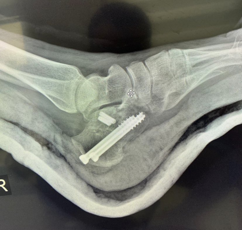 dr_haluk yaka tweet media