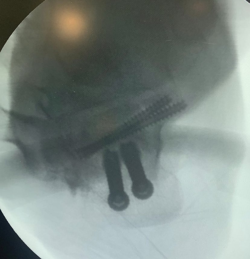 dr_haluk yaka tweet media