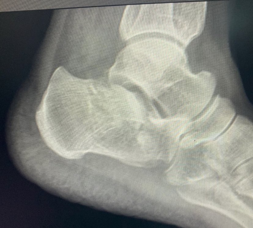 dr_haluk yaka tweet media