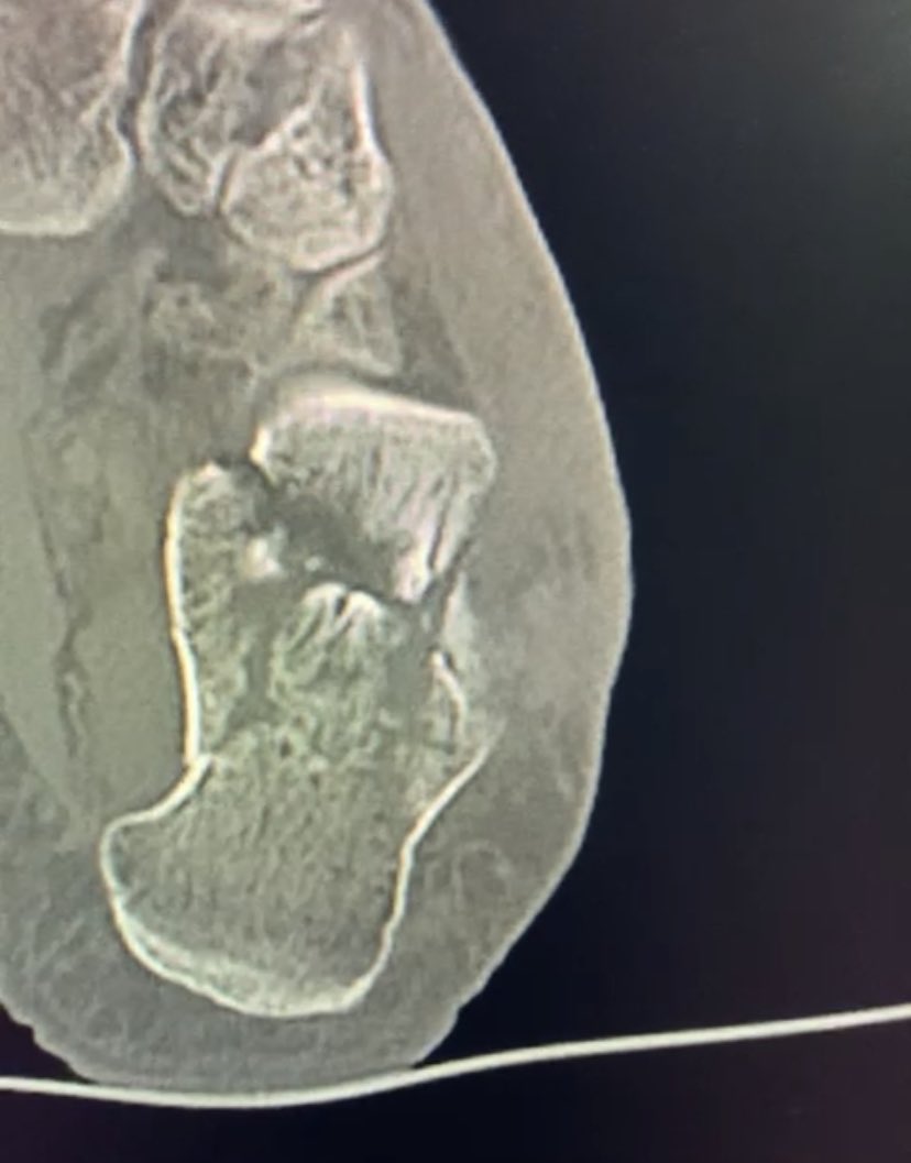 dr_haluk yaka tweet media