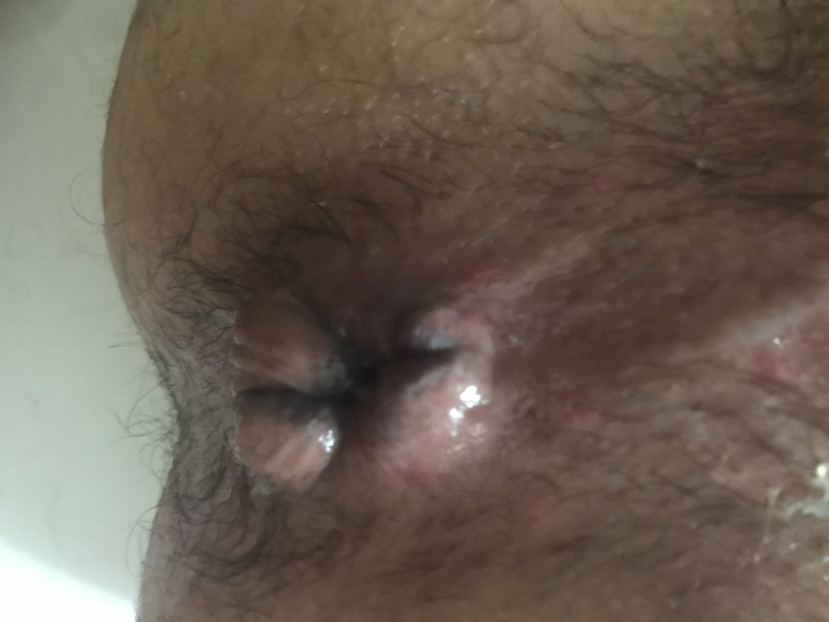 Andy32964974's tweet photo. Found these in my camera roll. Straight married guy hit me up wanting to get used. Told me if I he said no to make his drunk ass do it. #barebackdaddy #barebackingpig #marriedmen #suckingcock #gaymen #cumdumpwhore #cumdump https://t.co/cIvQkdCcGo