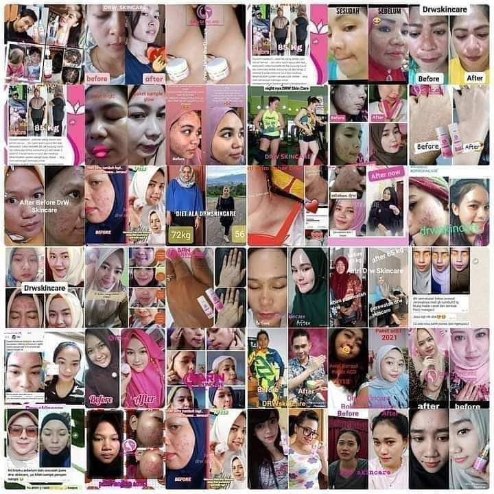 NurulDrw's tweet photo. Disaat km masih berfikir RIBUAN kali untuk beli DrW...

udah RIBUAN orang Yg PUAS dngn hasil DrW nya 🥰🙏
Freekonsultasi
WA 081374458290

#DrWskincare 
#DrWskincareIndonesia #DrWskincarepurworejo https://t.co/EEqqnoJfop