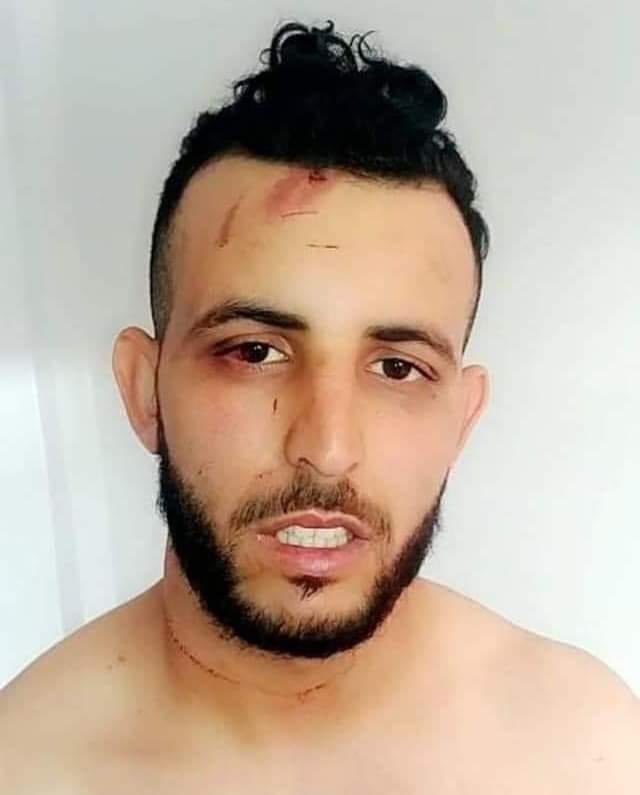 ⭕️Nabil Bouskin un jeune militant indépendantiste kabyle grièvement blessés lors de son arrestation a alger!

Il a été torturé et étranglé à l'aide d'un câble. 

Nous condamnons toutes formes de répression sur des militants quel que soit leur courant politique.