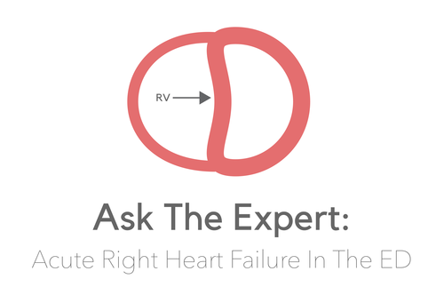 EMinMiami's tweet photo. Great post for #PostShiftTeaching about acute RV failure by @NorthwesternEM.

Read more here👇

https://t.co/mY3FvU5eDt

#FOAMed #MedEd #cardiology #cardiotwitter #POCUS #criticalcare #emergencymedicine https://t.co/w6DgcYkcMg