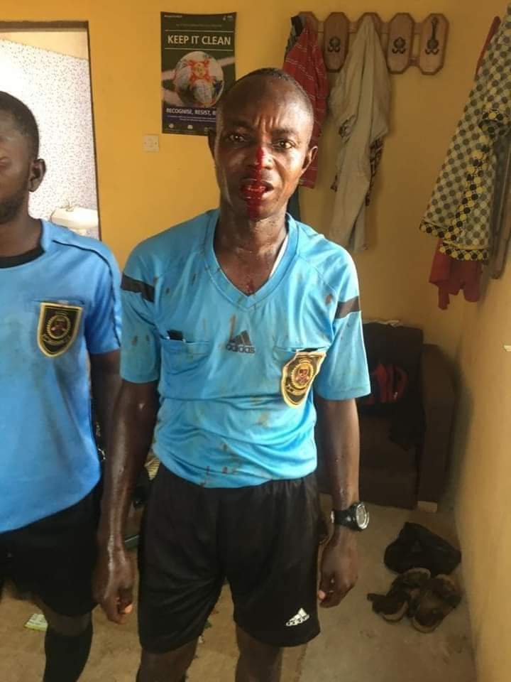 AfricaFactsZone's tweet photo. Some members of the audience, beat the referees in a Second Division Match in Ghana for making a decision they didn't agree with. https://t.co/b1Wm0HVQD4