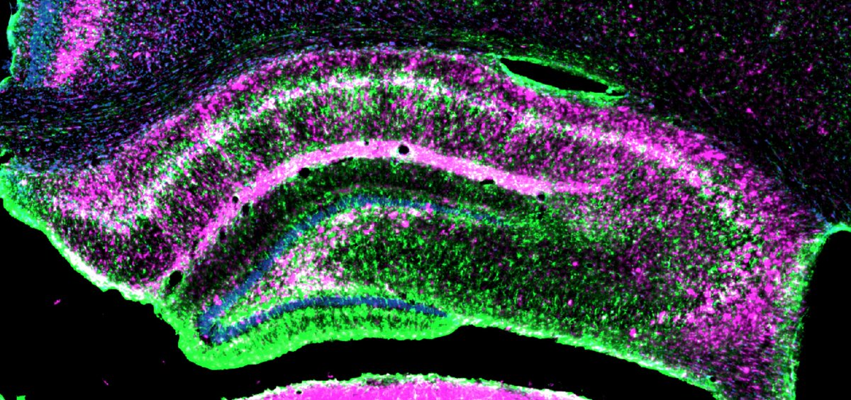 NadiaGasmi's tweet photo. Excited to share this first preprint from my thesis work! If you've ever wondered about the level of inflammation in the epileptic brain, check this out! Thread below👇
#neuroinflammation #epilepsy 

https://t.co/UUjhUklAlG

1/6 https://t.co/ptI4Ycx4ZM