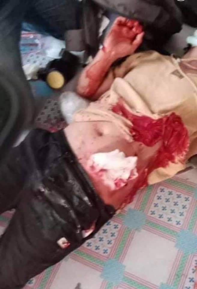 Tw//blood,death
As Military's sponsored Terrorists were continuously shooting with live ammos in #Taunggyi last night, 1 died,9 shot with live ammos 2 shot with rubber bullets Terrorists also took some injured civillians
#Mar29Coup
#WhatsHappeningInMyanmar