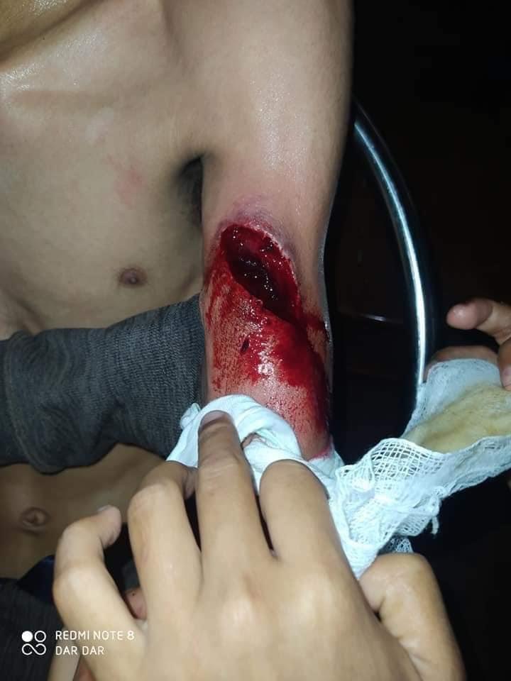 thiri_heather's tweet photo. South Dagon, military terrorists are using big weapons like RPGs and grenades to the neighbourhood housings today,many reported dead and many are in critical situation.

JUNTA MASSACRE
@freya_cole @TostevinM @RapporteurUn 
#Mar29Coup
#WhatIsHappeningInMyanmar https://t.co/9QhCbBuIpl