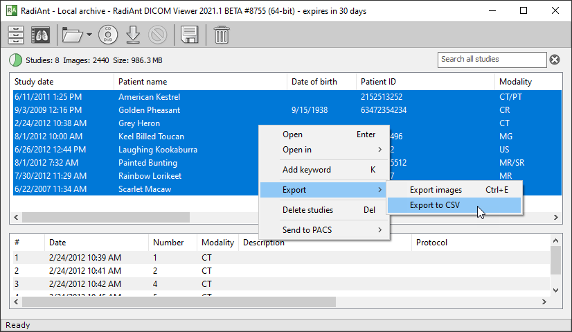 RadiAnt DICOM Viewer BETA 2021.1
radiantviewer.com/beta/

- Send studies to PACS (add-on package).
- CSV export in the local archive.
- Option to open quickly a series via context menu.