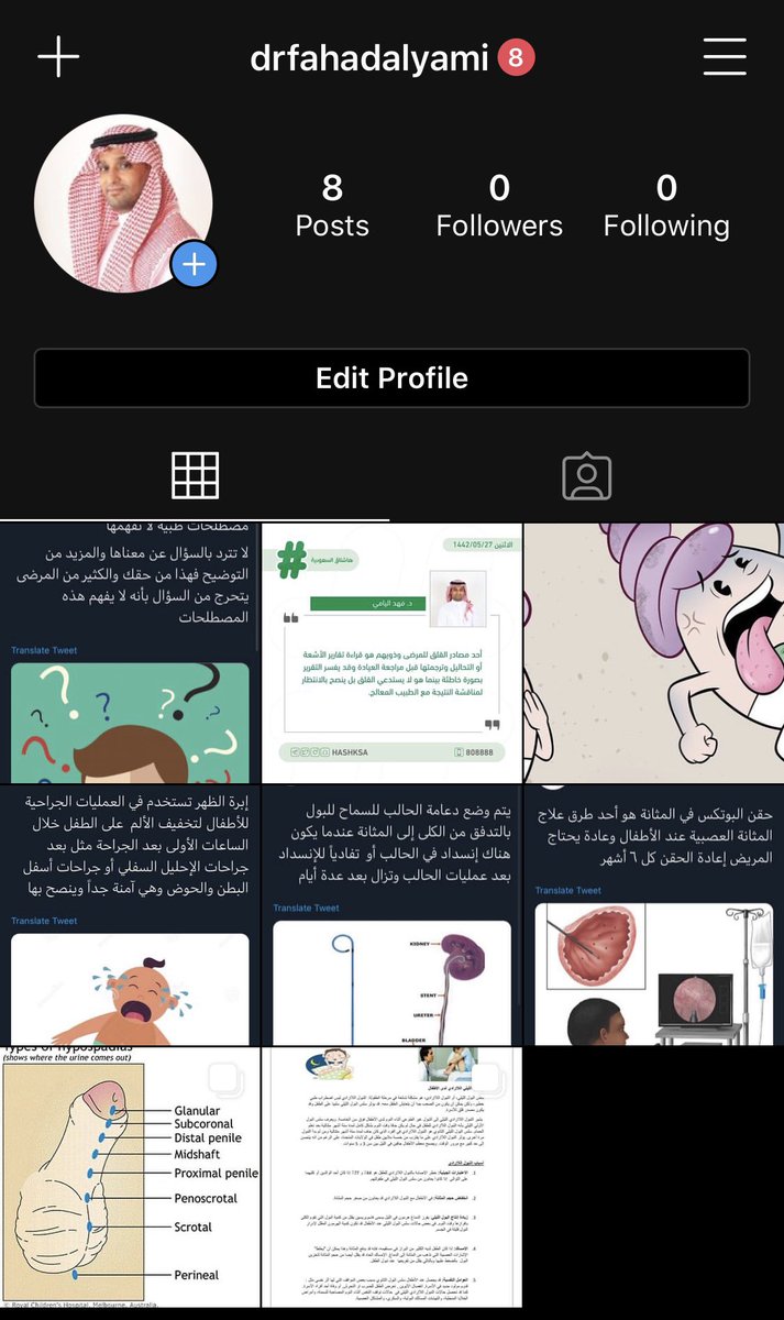 حياكم الله في حسابي الطبي في انستجرام
 
I'm on Instagram as drfahadalyami. Install the app to follow my photos and videos. instagram.com/invites/contac…