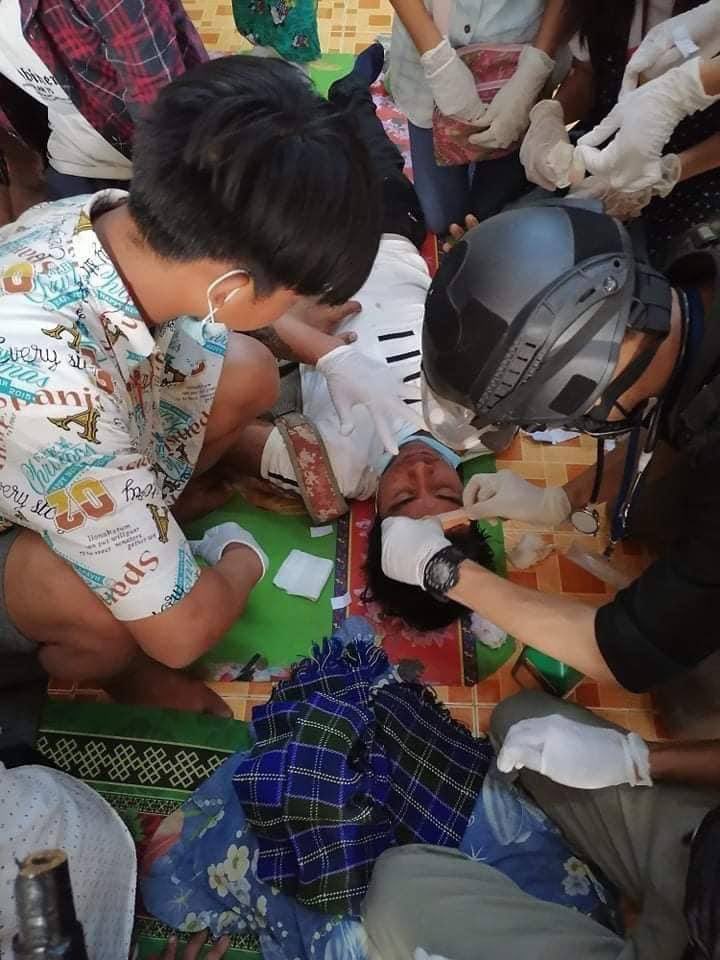3 got injured in forehead, neck and chest respectively during a violent crackdown and opening of gunfires by junta terrorirsts in Monywa.
#Mar29Coup
#WhatsHappeningInMyanmar