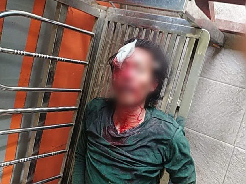 shafiur's tweet photo. #Mar29Coup South Dagon

SAC USING HAND GRENADES - reports. Circa 2.30pm. Many injured. 

#WhatsHappeningInMyanmar #Myanmar https://t.co/36hZniadaL