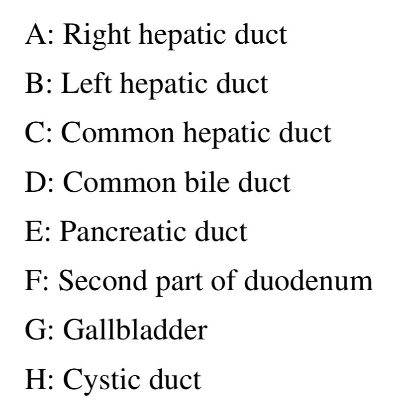 Biliary anatomy on MRCP @bmj_latest #GIQuiz #MedEd #LiverTwitter 

bmj.com/content/345/bm…