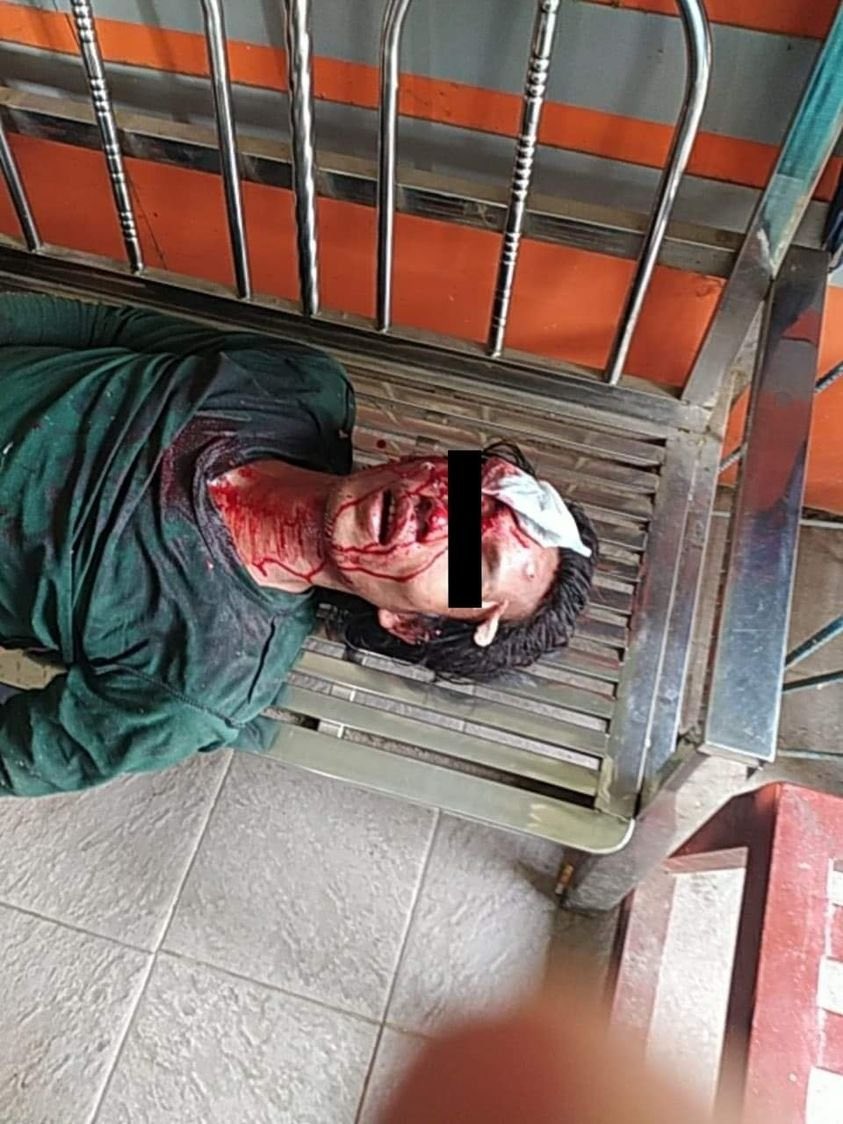 TW // BLOOD Update on #SouthDagon - 2 deaths confirmed and more than 4 injured! The rest still hard to confirm since it’s a complete battlefield. #WhatsHappeninglnMyanmar #Mar29Coup