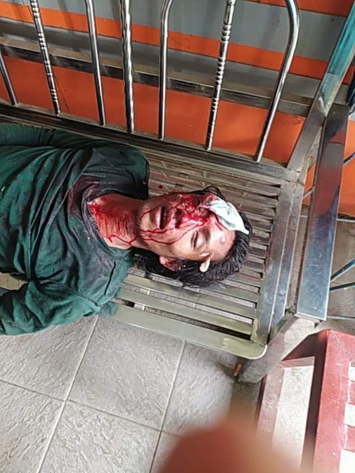 soe_pyar's tweet photo. @USAmbUN In South Dagon, Yangon, the Military even use bomb and machine guns to destroy the houses and to kill the people although the people are at home. The people have to face this violence since last night and till now. This is intentionally killing the people not the crack down. https://t.co/qtULLzkuvJ