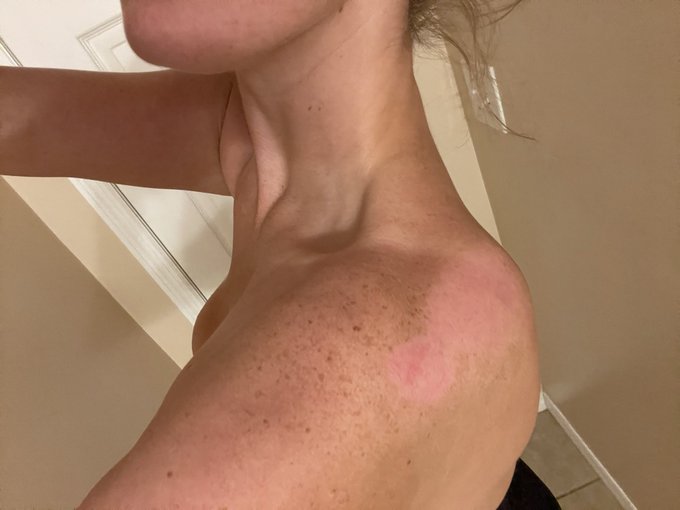 The scars remind me that the past is real. There&rsquo;s something really beautiful about a scar... https://t<a href="/tag/mvsales"class="tags"><span>#mvsales</span></a>