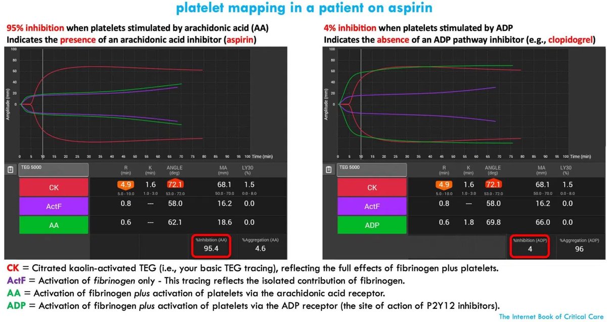 coagulation labs- new chapter!
🩸INR only correlates w/ clinical bleeding in a few situations (eg warfarin)
🩸TEG might more accurately reflect cell-based clotting in vivo?
🩸we order coags on nearly every patient, without fully understanding their meaning
emcrit.org/ibcc/coag/