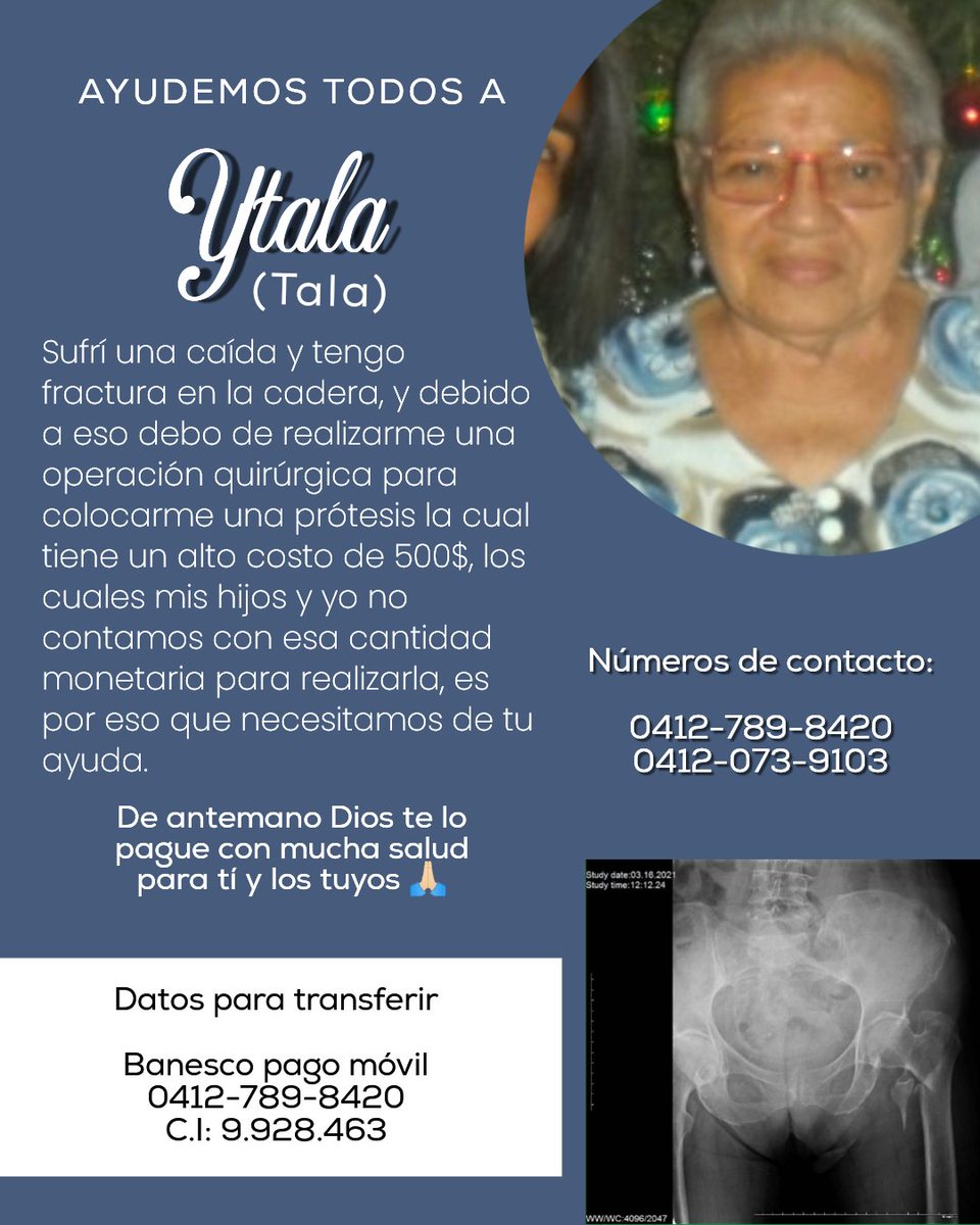 rbarbera9's tweet photo. Hola amigos, mi abuelita se cayó y necesitamos hacerle una operación, ya que se fracturó la cadera, pero tenemos que comprar la prótesis la cual tiene un costo de $500 los cuales no tenemos en estos momentos 😔. Le agradecería mucho que me ayudarán con un RT 🙏🏻 https://t.co/RAW03bf6UN
