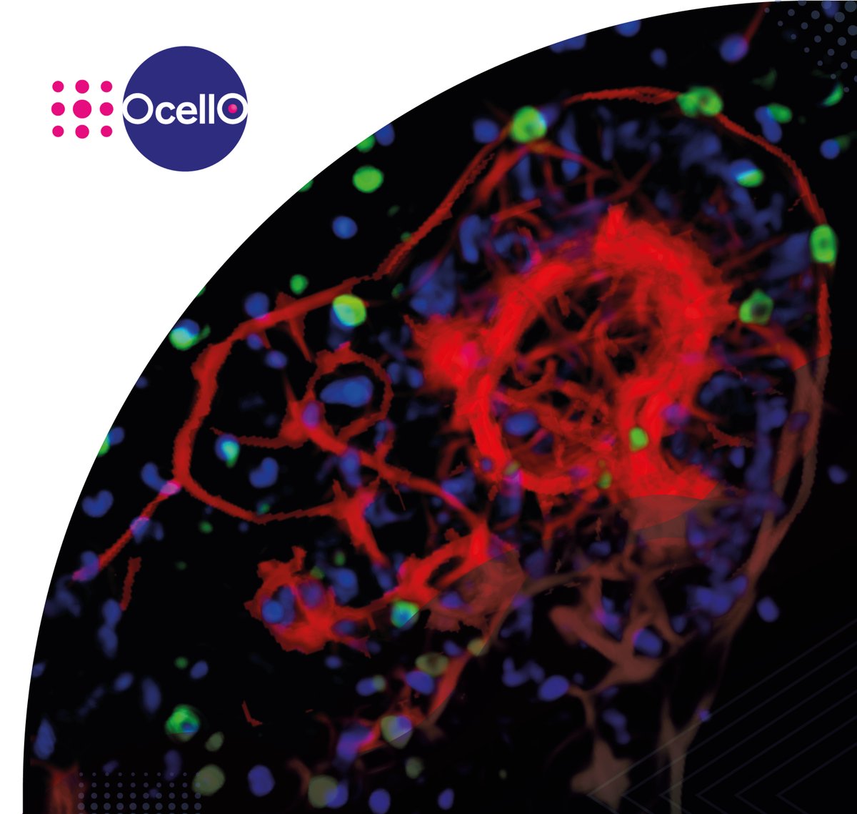 OcellO_3D's tweet photo. OcellO offers compound testing services using co-cultures of cancer and immune cells. Diverse cultured tumor tissues can be used in these assays. So, can you guess which tumor tissue is in this picture?

Learn more here: https://t.co/YuOcVrWv4L https://t.co/pw2nYTpzvc