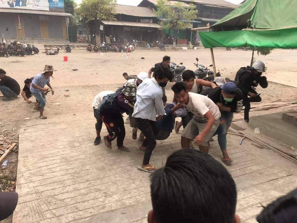 YungVictor7's tweet photo. tw // blood // wound
In Kalay City, Junta (SAC) violently crake down and 4 protestors from Women For Justice team have died and around 20 people were injured.
Rest in Power Brave Girls
JUNTA MASSACRE
#Mar29Coup
#WhatsHappeningInMyanmar https://t.co/hCWgkOtqJy