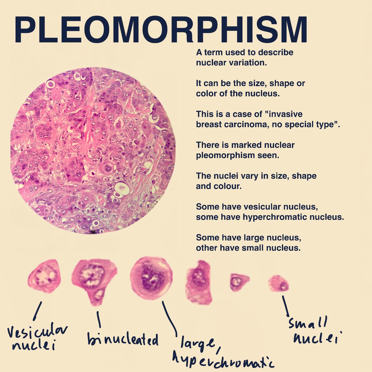 seoparjoo_'s tweet photo. A little bit on "pleomorphism". #mdusm #medicalstudent #medic #usmkk #usmkle #sainsperubatan #ppsp #ppsg #ppsk https://t.co/tjj1mjpTzN