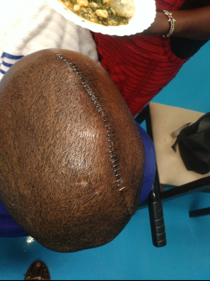 Oya KOT Lets normalize helping the helpless
Help our bro here
Dancan Kibuchi medications through:
Paybill No: 891300
Account No: 46009.
You can also call his father through 07296315540

Rtwt widely

#KibuchiMedicalAppeal