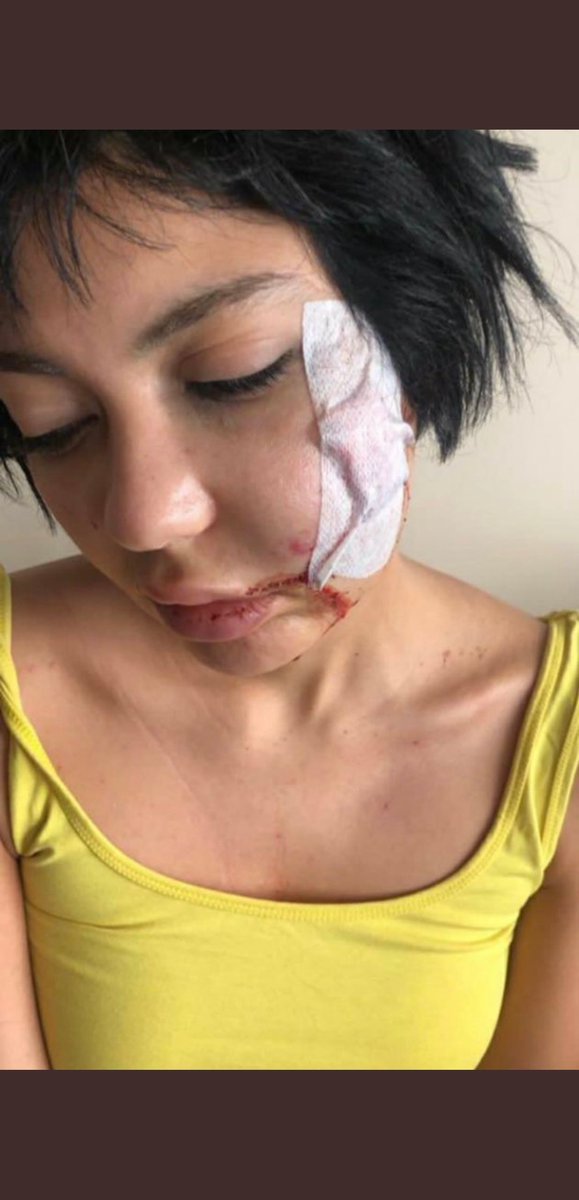 Bir insan birini sevmiyor olabilir görüşlerini ,giyim tarzını ,yapısını, karakterini beğenmiyor olabilir ama ne olursa olsun karşındaki insan ve saygı duymak zorundasın bunu yapan kişi serbest bırakıldı ve diğer zihniyette ki insanlara cesaret verdi
#BaharCandanYalnızDeğildir