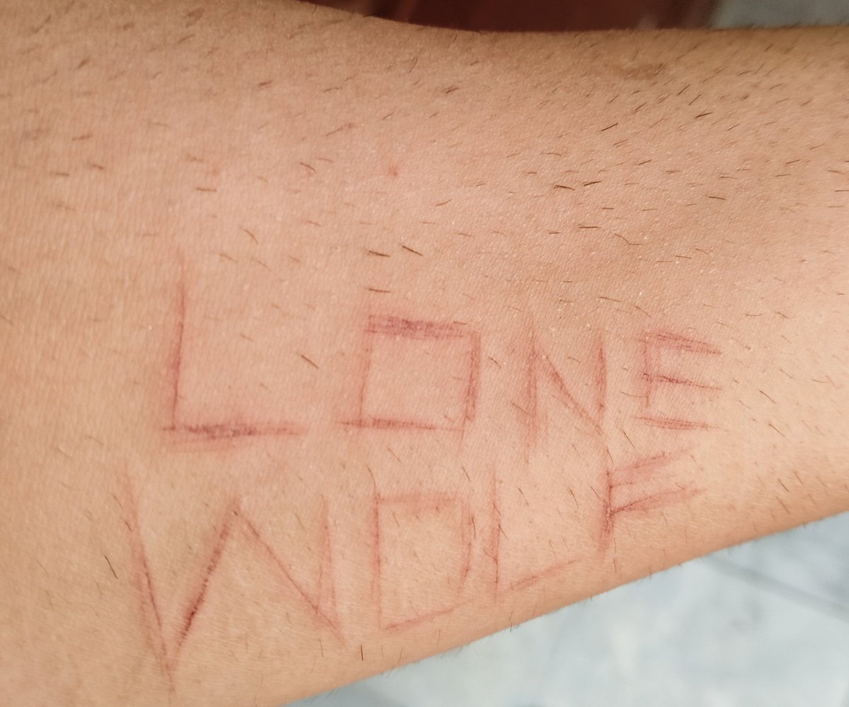 sheraz_0505's tweet photo. Alots of moments in my life I wished I could die but some things were more important then that ....
#lonewolf
#itzs19 https://t.co/oTPs1kvepe